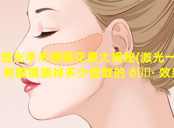 激光手术摘镜花费大揭秘(激光一照眼镜摘掉多少度数的 🌷 效果最好)